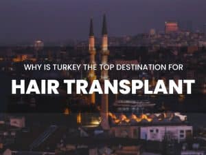 14 Reasons to Choose Turkey as the Top Destination for Hair Transplantation